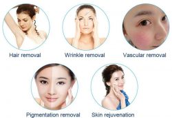 SHR Laser Hair Removal