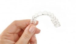 Orthodontic Treatment in Calgary