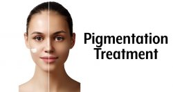 Skin pigmentation