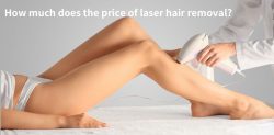 Laser Hair Removal