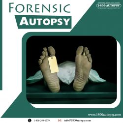 Forensic Autopsy