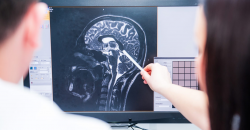 How to Prevent Dementia Naturally