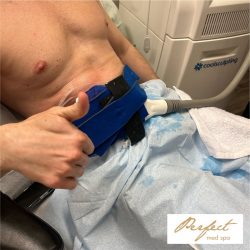 Coolsculpting In New York city