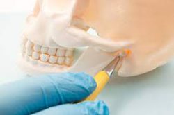 TMJ Treatment Houston TX | TMJ Treatment Near Me – Edge Dental