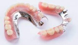 Affordable Partial Dentures in Cypress, TX