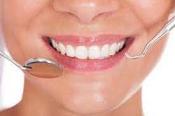 Gingivectomy | Dental Office in Houston Texas, 77084