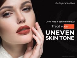 Dr. Rajat Kandhari – Skin Specialist in Delhi