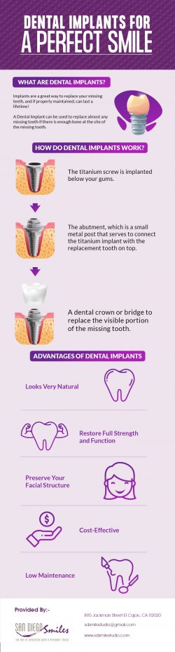 Get Quality Implant Dentistry in El Cajon, CA from San Diego Smiles