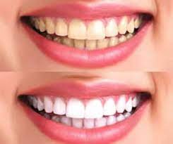 Find The Best Dentist in Aventura, FL