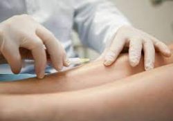 Vein Treatments Long Island | Board Certified Vein Treatment Experts LI