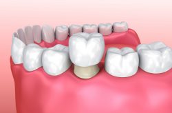 Emergency Dentist in Spring Branch, TX