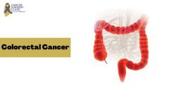 Best Cancer Hospital For Colorectal Cancer Treatment