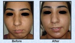 Best Plastic Surgeon in Delhi for All Solution – Dr. Vivek Kumar