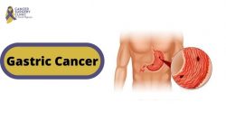 CancerSurgeryClinic For Gastric Cancer Treatments