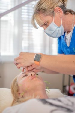 Facial Acupuncture