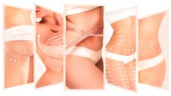 Houston Cosmetic Surgery Center | Body Procedures