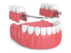 Full Dentures & Partial Dentures | Dentist in 77084