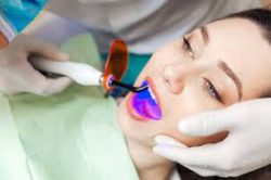 What is Laser Dentistry? | Houston Laser Dentistry | Laser Teeth Whitening