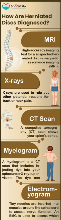 Herniated(slipped) Disc Symptoms