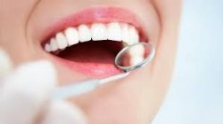 Teeth Whitening Near Me | Zoom Teeth Whitening Houston TX