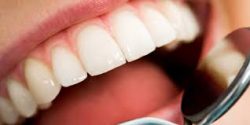 Dentist In Houston TX – Book Your Appointment Now At URBN Dental