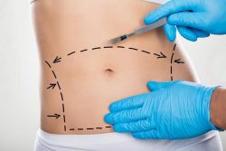 Tummy Tuck in Reno