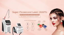 Laser Tattoo Removal