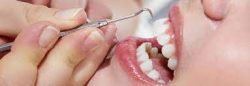 Deep Teeth Cleaning Near Me | Deep Cleaning Teeth Cost