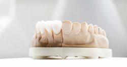 Porcelain Crowns and Bridges Dental Care | URBN Dental in Houston TX
