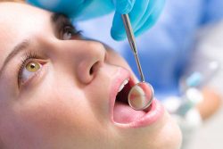 Universal Dental Notation | Dental Numbering Chart | Teeth Numbers And Names