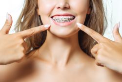 Braces Orthodontist Near Me in Miami | Best Orthodontic Center in Miami