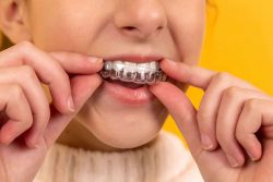 Methods For Overbite Correction | Invisalign and Braces Fix an Overbite