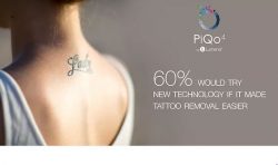 Best Laser Tattoo Removal NY | Skin Clinic Tattoo Removal NY – Bared Monkey