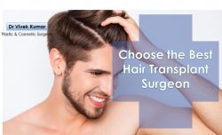 Best Hair Transplant Surgeon Clinic in Delhi – Dr. Vivek Kumar