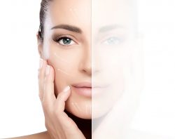 Anti Wrinkle Treatments