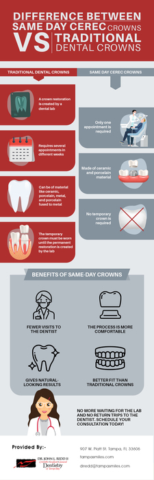 Get Natural-looking Dental Crowns In Tampa From Tampa Smiles