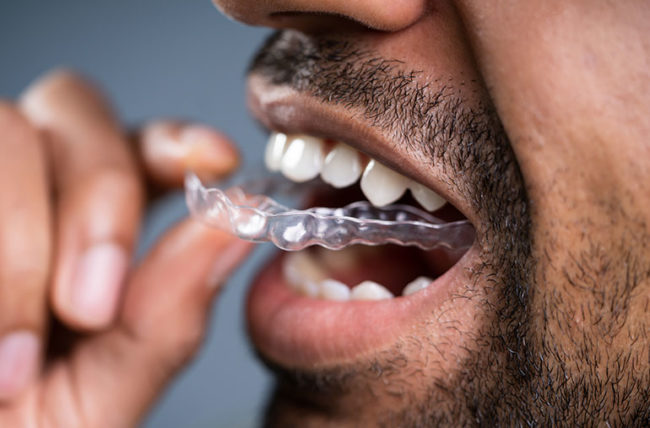 Tooth Pain After Dental Work | TMJ Dentist Near Me