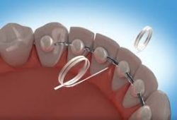 Top Orthodontist Aventura | American Association of Orthodontists Miami