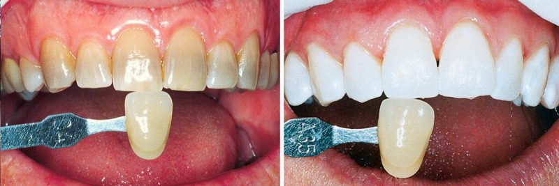 Find the Best Dental Clinic near me in Houston, TX | Dental and Oral Care