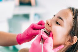 Children’s Orthodontist Near Me | Tips From Orthodontist In Aventura, FL