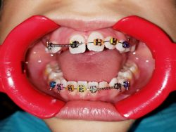 Orthodontist Open Saturday Near Me | Orthodontist Open on Weekends