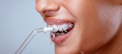 Traditional Flossing vs Water Flossing: Which One Prevents Teeth Loss?