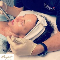 Non-Invasive Skin Tightening Procedures