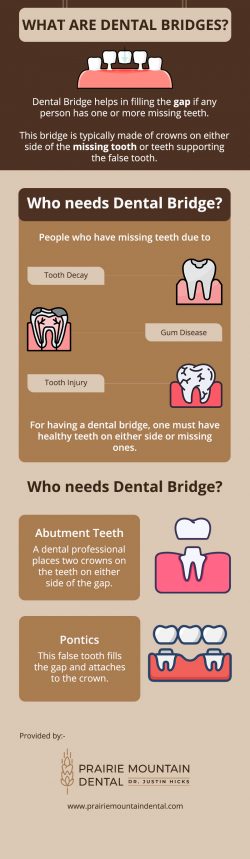 Restore Your Smile With Dental Bridge in Helena, MT