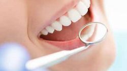 Dental Crowns And Bridges Near Me | Dentist Houston TX