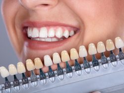 Porcelain Dental Crowns in Cypress, Texas