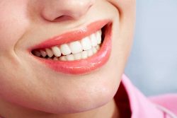 How Braces Work to Straighten your Teeth? – URBN Dental Midtown Dentist Houston