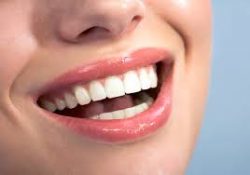 Affordable Dental Implants Near Me