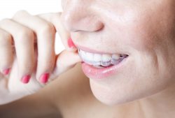 Retainer Care And Instructions | 6 Tips For The Perfect Retainer Care