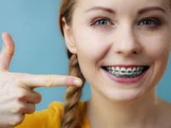 Find The Best Orthodontist In Houston, TX